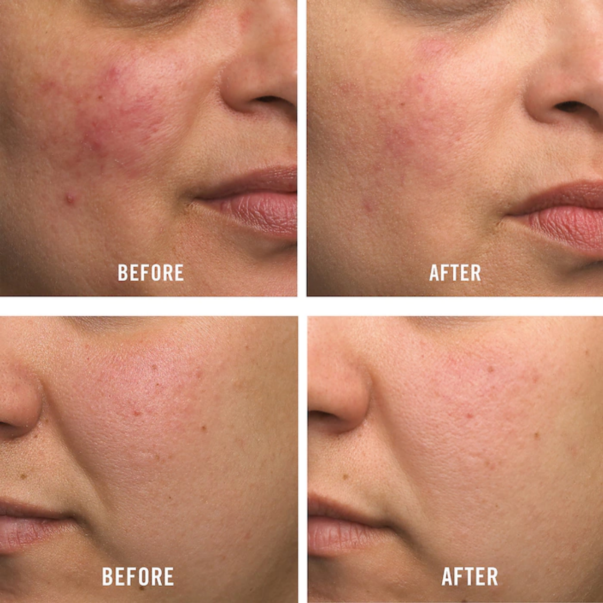Ultra Repair Cream Intense Hydration (170g)
